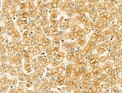 Invitrogen Clathrin Light Chain Polyclonal Antibody 100 &mu;L; Unconjugated:Antibodies,