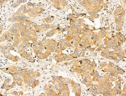 Invitrogen Clathrin Light Chain Polyclonal Antibody 100 &mu;L; Unconjugated:Antibodies,