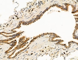 Invitrogen Clathrin Light Chain Polyclonal Antibody 100 &mu;L; Unconjugated:Antibodies,