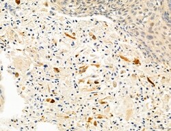 Invitrogen Clathrin Light Chain Polyclonal Antibody 100 &mu;L; Unconjugated:Antibodies,