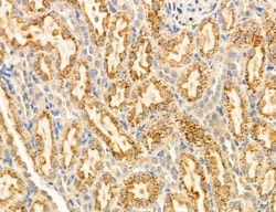 Invitrogen Clathrin Light Chain Polyclonal Antibody 100 &mu;L; Unconjugated:Antibodies,