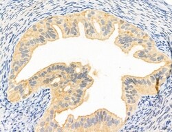 Invitrogen Clathrin Light Chain Polyclonal Antibody 100 &mu;L; Unconjugated:Antibodies,