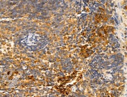 Invitrogen Clathrin Light Chain Polyclonal Antibody 100 &mu;L; Unconjugated:Antibodies,