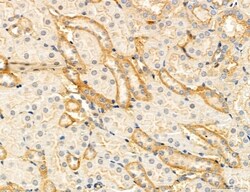 Invitrogen Clathrin Light Chain Polyclonal Antibody 100 &mu;L; Unconjugated:Antibodies,