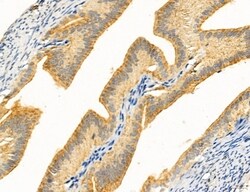 Invitrogen Clathrin Light Chain Polyclonal Antibody 100 &mu;L; Unconjugated:Antibodies,
