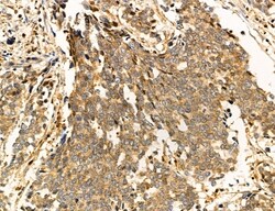 Invitrogen Clathrin Light Chain Polyclonal Antibody 100 &mu;L; Unconjugated:Antibodies,