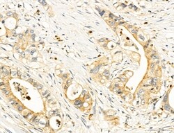 Invitrogen Clathrin Light Chain Polyclonal Antibody 100 &mu;L; Unconjugated:Antibodies,