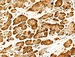 Invitrogen Clathrin Light Chain Polyclonal Antibody 100 &mu;L; Unconjugated:Antibodies,