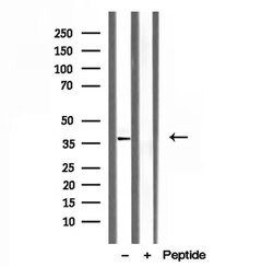 Invitrogen Clathrin Light Chain Polyclonal Antibody 100 &mu;L; Unconjugated:Antibodies,