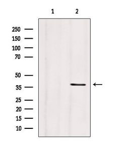 Invitrogen Clathrin Light Chain Polyclonal Antibody 100 &mu;L; Unconjugated:Antibodies,