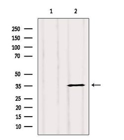 Invitrogen Clathrin Light Chain Polyclonal Antibody 100 &mu;L; Unconjugated:Antibodies,