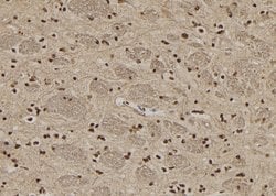 Invitrogen Coilin Polyclonal Antibody 100 &mu;L; Unconjugated:Antibodies,