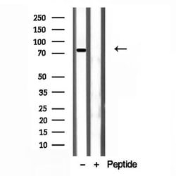 Invitrogen Coilin Polyclonal Antibody 100 &mu;L; Unconjugated:Antibodies,
