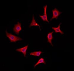 Invitrogen IFT25 Polyclonal Antibody 100 &mu;L; Unconjugated:Antibodies,