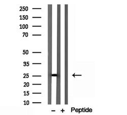 Invitrogen IFT25 Polyclonal Antibody 100 &mu;L; Unconjugated:Antibodies,