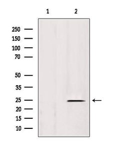 Invitrogen IFT25 Polyclonal Antibody 100 &mu;L; Unconjugated:Antibodies,