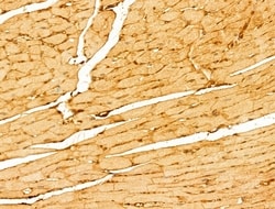 Invitrogen LMOD1 Polyclonal Antibody 100 &mu;L; Unconjugated:Antibodies,