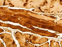 Invitrogen LMOD1 Polyclonal Antibody 100 &mu;L; Unconjugated:Antibodies,
