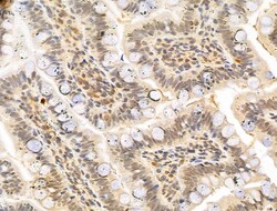 Invitrogen MCM10 Polyclonal Antibody 100 &mu;L; Unconjugated:Antibodies,
