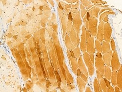 Invitrogen Melanophilin Polyclonal Antibody 100 &mu;L; Unconjugated:Antibodies,