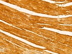 Invitrogen Melanophilin Polyclonal Antibody 100 &mu;L; Unconjugated:Antibodies,