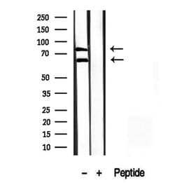Invitrogen Melanophilin Polyclonal Antibody 100 &mu;L; Unconjugated:Antibodies,