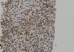 Invitrogen PTPN23 Polyclonal Antibody 100 &mu;L; Unconjugated:Antibodies,