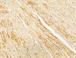 Invitrogen PTPN23 Polyclonal Antibody 100 &mu;L; Unconjugated:Antibodies,