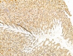 Invitrogen PTPN23 Polyclonal Antibody 100 &mu;L; Unconjugated:Antibodies,