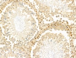 Invitrogen PTPN23 Polyclonal Antibody 100 &mu;L; Unconjugated:Antibodies,