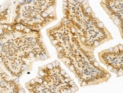 Invitrogen PTPN23 Polyclonal Antibody 100 &mu;L; Unconjugated:Antibodies,