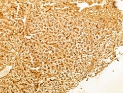 Invitrogen PTPN23 Polyclonal Antibody 100 &mu;L; Unconjugated:Antibodies,