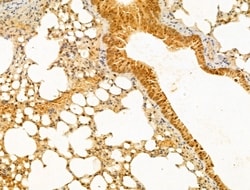 Invitrogen PTPN23 Polyclonal Antibody 100 &mu;L; Unconjugated:Antibodies,
