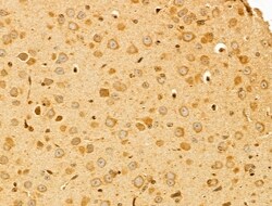 Invitrogen PTPN23 Polyclonal Antibody 100 &mu;L; Unconjugated:Antibodies,