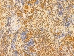 Invitrogen PTPN23 Polyclonal Antibody 100 &mu;L; Unconjugated:Antibodies,