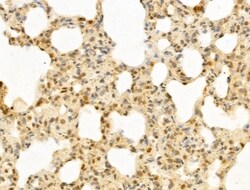 Invitrogen PTPN23 Polyclonal Antibody 100 &mu;L; Unconjugated:Antibodies,