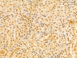 Invitrogen PTPN23 Polyclonal Antibody 100 &mu;L; Unconjugated:Antibodies,