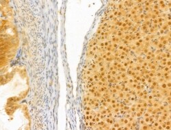Invitrogen PTPN23 Polyclonal Antibody 100 &mu;L; Unconjugated:Antibodies,