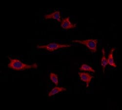 Invitrogen RPGRIP1L Polyclonal Antibody 100 &mu;L; Unconjugated:Antibodies,