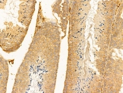 Invitrogen RPGRIP1L Polyclonal Antibody 100 &mu;L; Unconjugated:Antibodies,