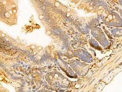 Invitrogen RPGRIP1L Polyclonal Antibody 100 &mu;L; Unconjugated:Antibodies,