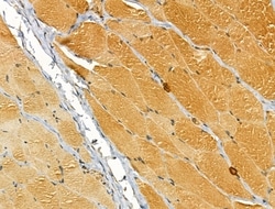 Invitrogen TTLL6 Polyclonal Antibody 100 &mu;L; Unconjugated:Antibodies,
