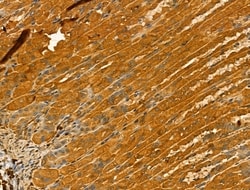 Invitrogen TTLL6 Polyclonal Antibody 100 &mu;L; Unconjugated:Antibodies,