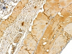 Invitrogen TTLL6 Polyclonal Antibody 100 &mu;L; Unconjugated:Antibodies,