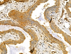 Invitrogen TTLL6 Polyclonal Antibody 100 &mu;L; Unconjugated:Antibodies,