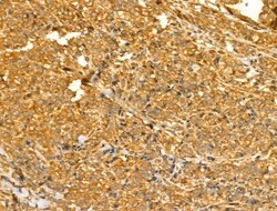 Invitrogen TTLL6 Polyclonal Antibody 100 &mu;L; Unconjugated:Antibodies,