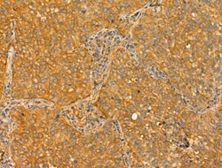 Invitrogen TTLL6 Polyclonal Antibody 100 &mu;L; Unconjugated:Antibodies,