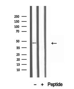 Invitrogen TTLL6 Polyclonal Antibody 100 &mu;L; Unconjugated:Antibodies,