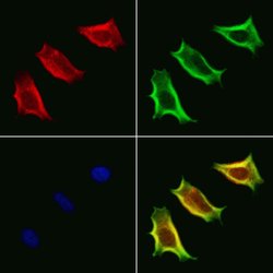 Invitrogen VPS33B Polyclonal Antibody 100 &mu;L; Unconjugated:Antibodies,