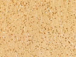 Invitrogen YTHDF2 Polyclonal Antibody 100 &mu;L; Unconjugated:Antibodies,